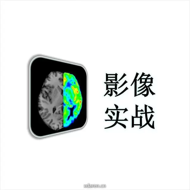 影像实战